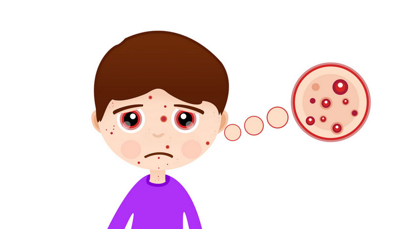 皮膚癌不是防癌險(xiǎn)說的那種“癌”